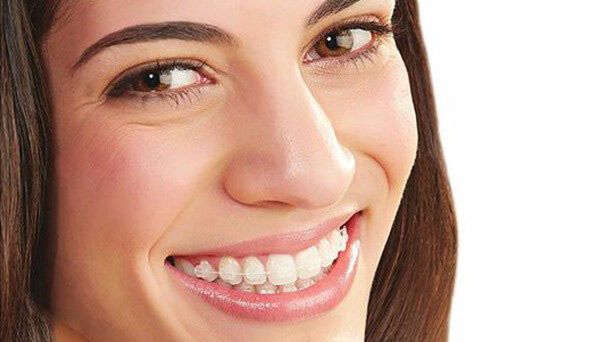 Clínica de Ortodoncia José Selfa mujer sonriendo